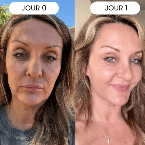 The Complete Micro-Infusion Lift Pro® Routine