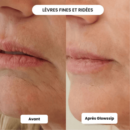 The Complete Micro-Infusion Lift Pro® Routine
