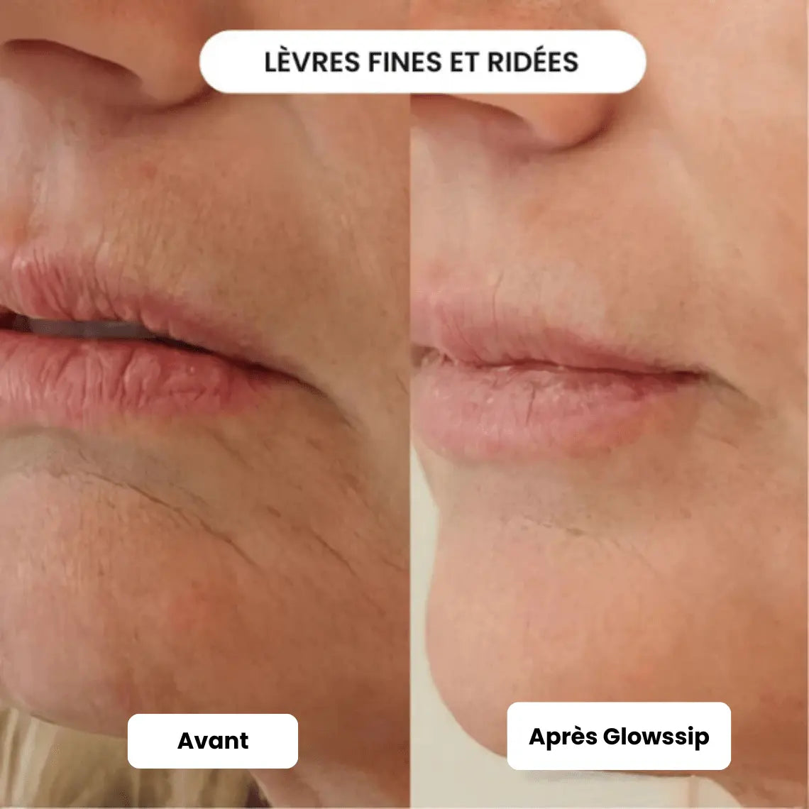 The Complete Micro-Infusion Lift Pro® Routine