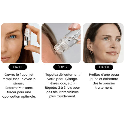 Micro Infusion System