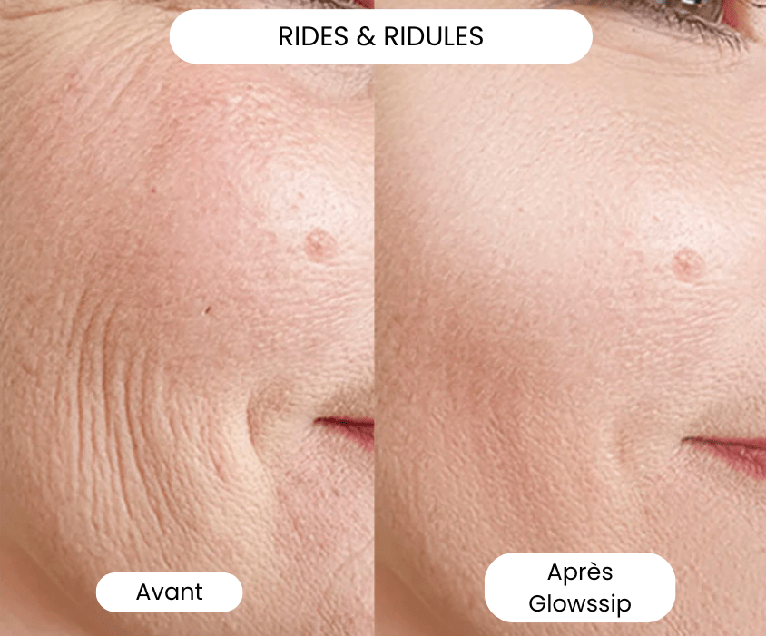 The Complete Micro-Infusion Lift Pro® Routine