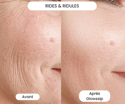 The Complete Micro-Infusion Lift Pro® Routine
