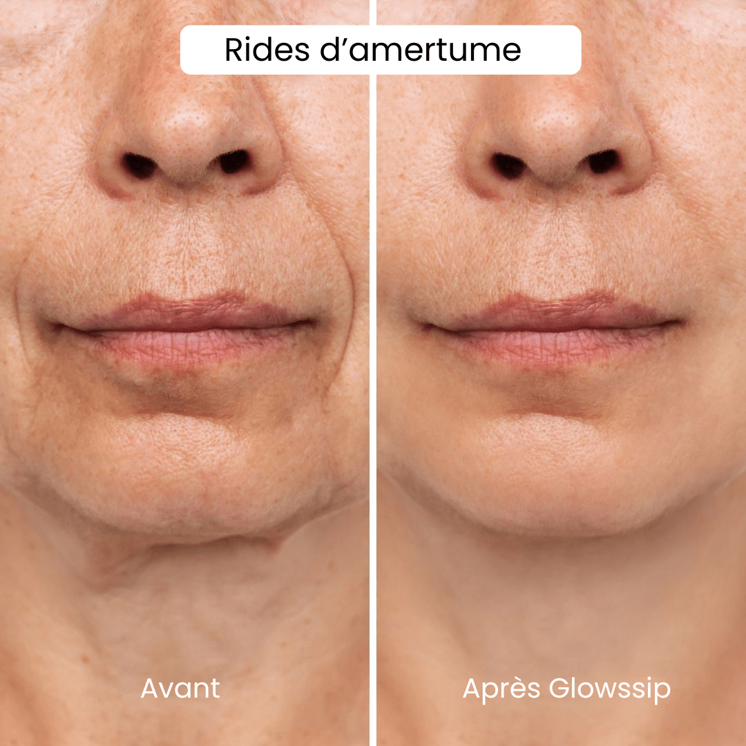 The Complete Micro-Infusion Lift Pro® Routine