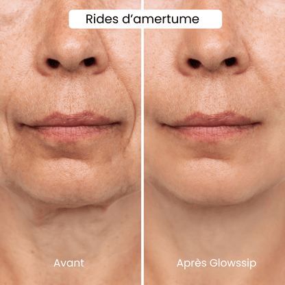 The Complete Micro-Infusion Lift Pro® Routine