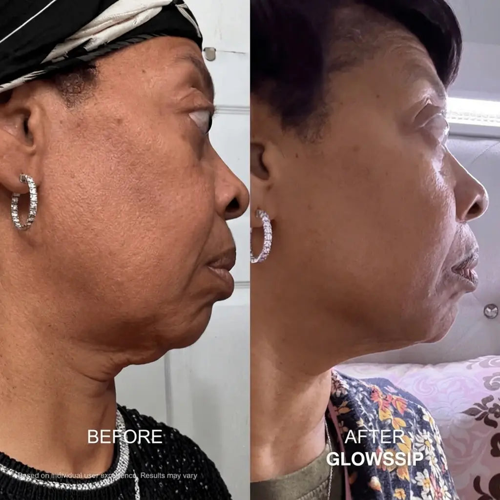 4 Months Micro-Infusion System + 4 FREE Gifts