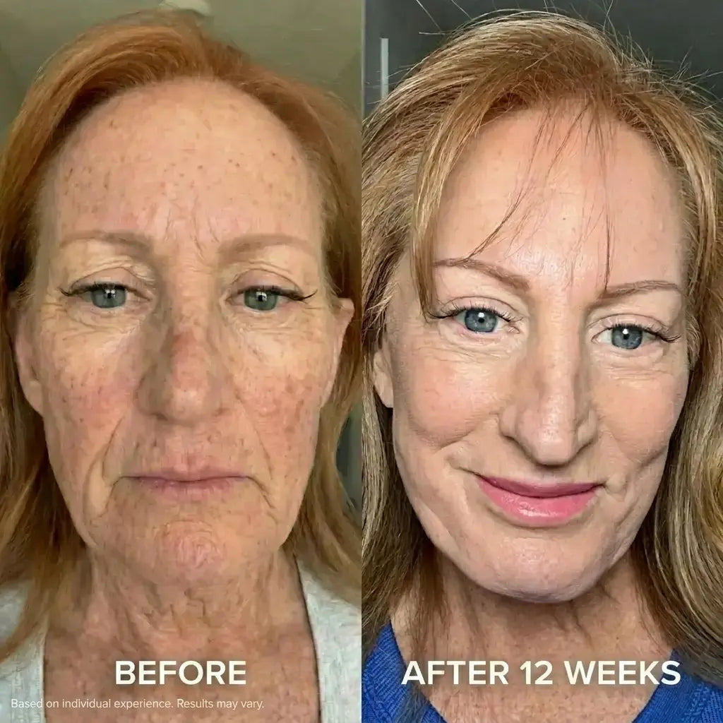 The Micro Infusion System™
